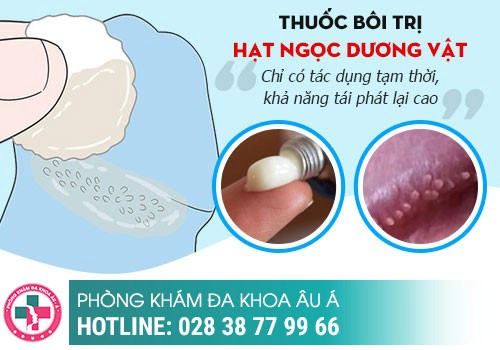 thuốc chữa trị hạt ngọc dương vật