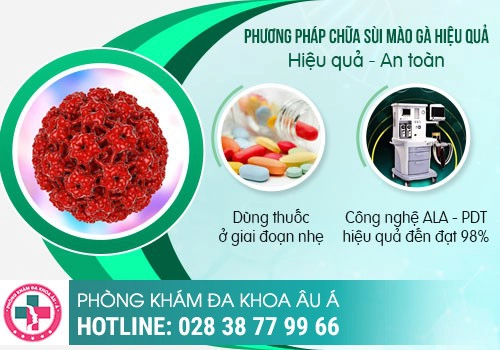 Phương pháp đốt sùi mào gà như thế nào?