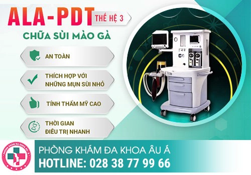 Cách khắc phục sùi mào gà ở bộ phận sinh dục nữ hiệu quả