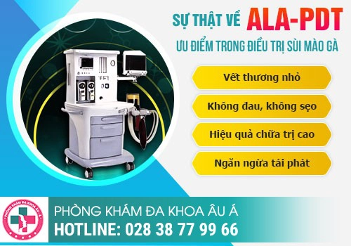 Cách chữa trị bệnh sùi mào gà hiệu quả nhất