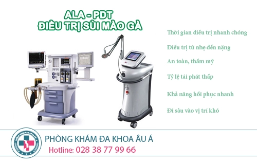Điều trị sùi mào gà