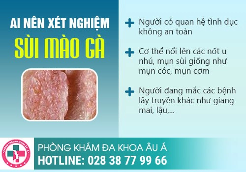 Quy trình xét nghiệm sùi mào gà