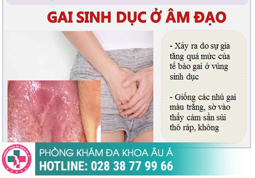 Gai âm đạo là gì? Phân biệt gai âm đạo và sùi mào gà