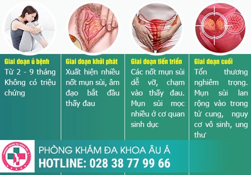 Sùi mào gà là gì?