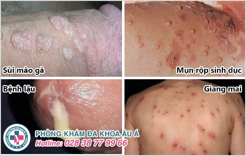 bệnh viện da liễu chữa bệnh xã hội