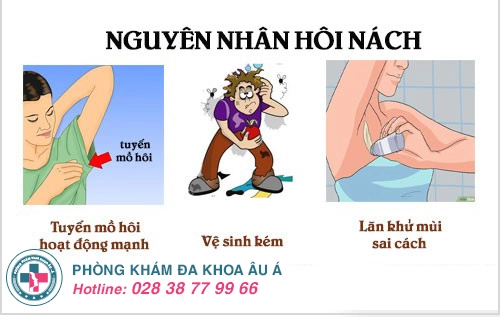 Cách chữa hôi nách lấy lại sự tự tin