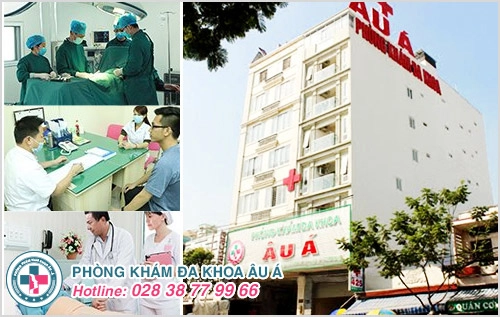 Chi phí chữa hôi nách hết bao nhiêu tiền?