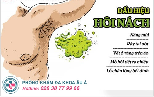 Dấu hiệu hôi nách không thể bỏ qua