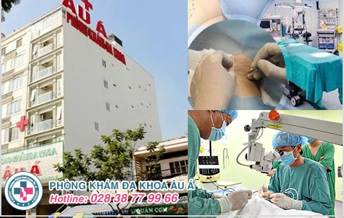Dấu hiệu hôi nách không thể bỏ qua