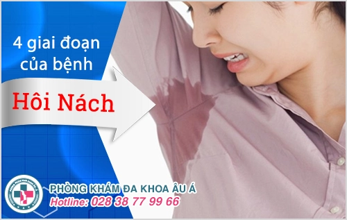 Cách chữa hôi nách lấy lại sự tự tin