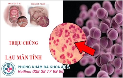 Bệnh lậu là gì? Giải đáp của bác sĩ chuyên khoa