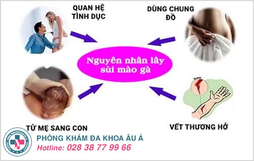 Nguyên nhân triệu chứng sùi mào gà và cách chữa