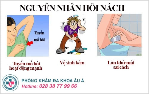 Triệu chứng hôi nách