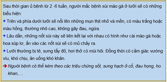 sùi mào gà ở lưỡi