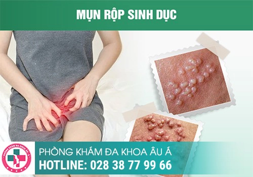 mụn rộp sinh dục nữ