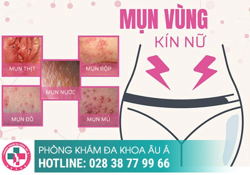 Nguyên nhân nổi mụn bọc ở vùng kín