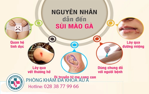 thong tin benh sui mao ga