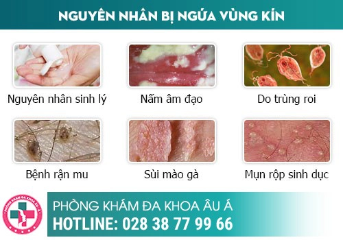 ngứa rát bộ phận sinh dục
