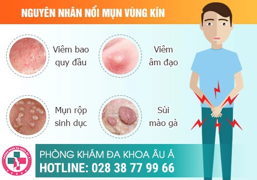 Nguyên nhân nổi mụn li ti ở bao quy đầu là gì?