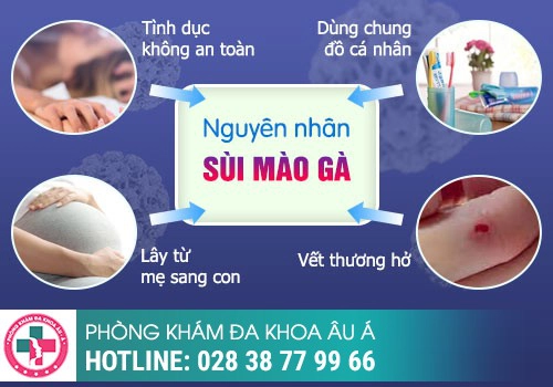 Nguyên nhân gây bệnh sùi mào gà là gì?