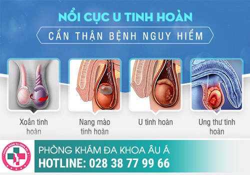 Những dấu hiệu khi nổi hạch ở tinh hoàn