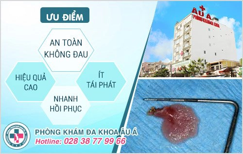 Đốt sùi mào gà có trị dứt điểm được sùi mào gà không?
