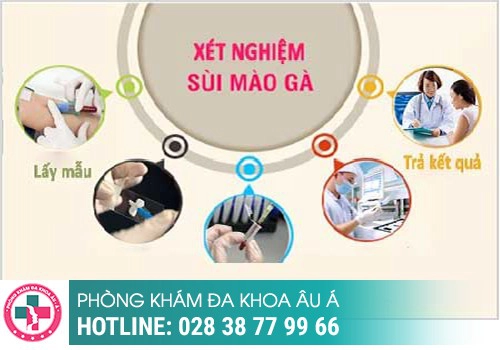 Giá xét nghiệm sùi mào gà