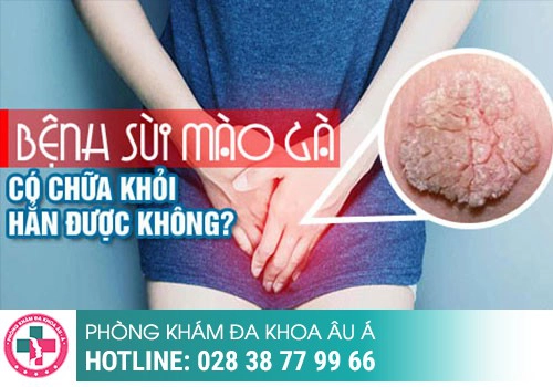 Sùi mào gà tái phát