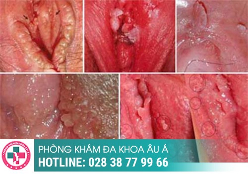 xét nghiệm tổng quát bệnh xã hội