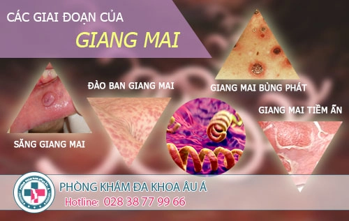 Tất tần tật thông tin về bệnh giang mai