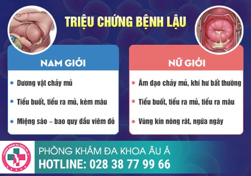 biểu hiện ban đầu bệnh lậu ở nam