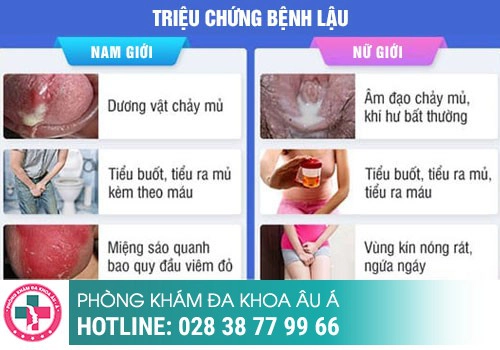 Tìm hiểu chung về bệnh lậu