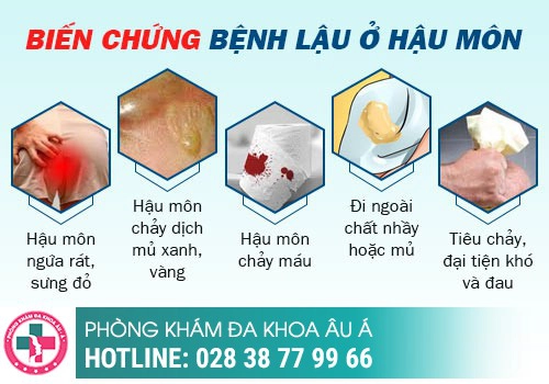 Dấu hiệu nhận biết bệnh lậu ở hậu môn là gì?