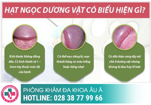 Hình ảnh hạt ngọc dương vật