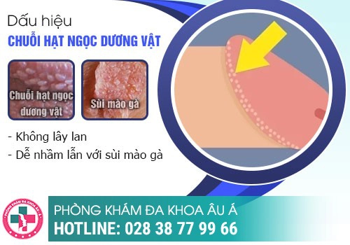 Hình ảnh hạt ngọc dương vật