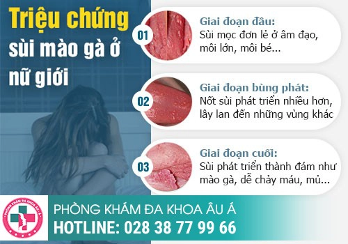 biểu hiện sùi mào gà