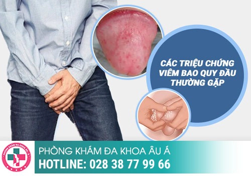 Lỗ sáo chảy mủ là bị bệnh gì