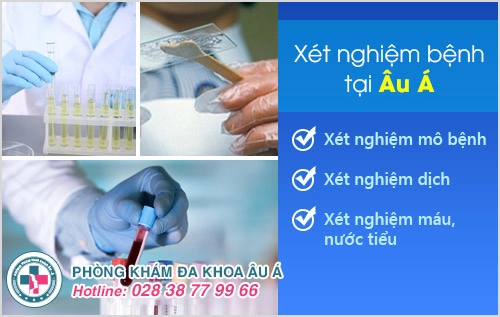 Quan hệ tình dục không an toàn