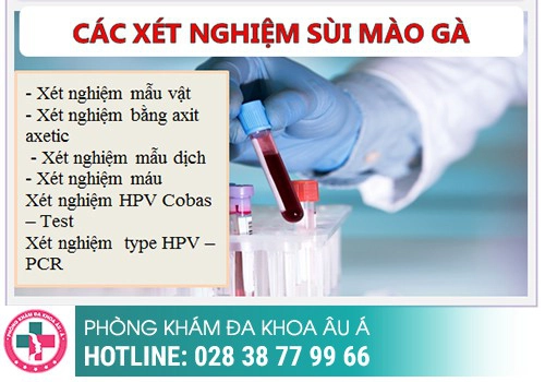 Cách xét nghiệm sùi mào gà hiện nay