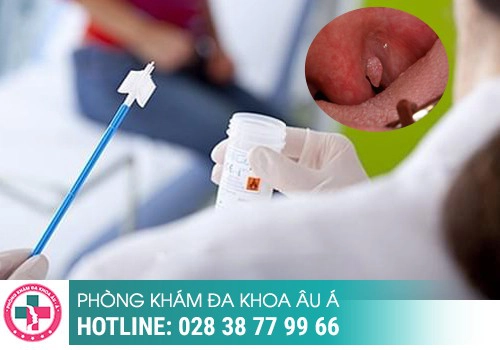 xét nghiệm các bệnh xã hội