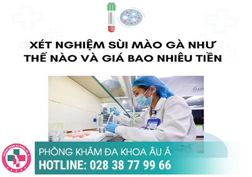 Giá xét nghiệm sùi mào gà