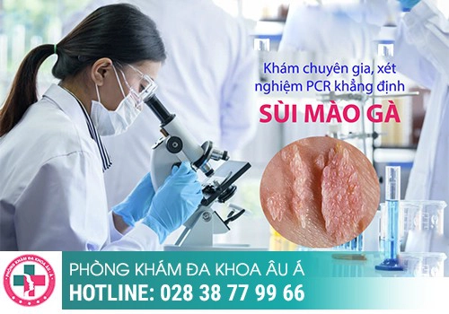 Giá xét nghiệm sùi mào gà