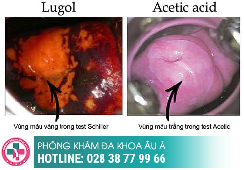 Xét nghiệm bệnh xã hội
