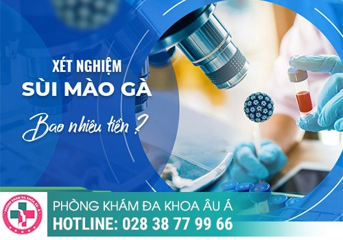 Chi phí xét nghiệm sùi mào gà là bao nhiêu?