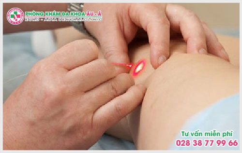 Đốt sùi mào gà bằng laser như thế nào tại Đa Khoa Âu Á? Đây chính là nỗi lo lắng của rất nhiều người vẫn chưa tiến hành điều trị dứt điểm.