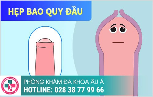 HÌNH ẢNH BỆNH NGOẠI KHOA NAM THƯỜNG GẶP