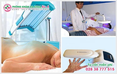 Bệnh bạch biến có nguy hiểm không?
