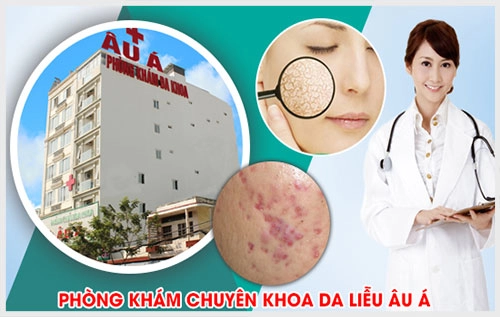 Không những đảm bảo những yếu tố của một cơ  khám chữa bệnh da liễu uy tín mà Đa Khoa Âu Á còn là địa chỉ giúp người bệnh có thể tiết kiệm tối đa thời gian, chi phí cũng như công sức của mình. 