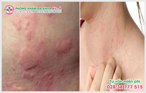 Để biết cách trị bệnh ngứa ngoài da nào phù hợp thì theo lời khuyên của các bác sĩ bệnh nhân nên tìm đến những phòng khám chuyên khoa để được tư vấn