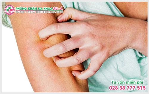 Để biết cách trị bệnh ngứa ngoài da nào phù hợp thì theo lời khuyên của các bác sĩ bệnh nhân nên tìm đến những phòng khám chuyên khoa để được tư vấn